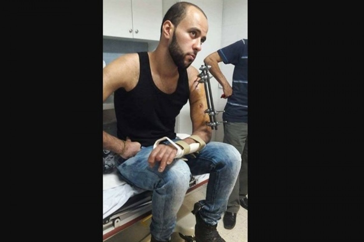 الجريح أكرم عمران الاطرش23 عاما