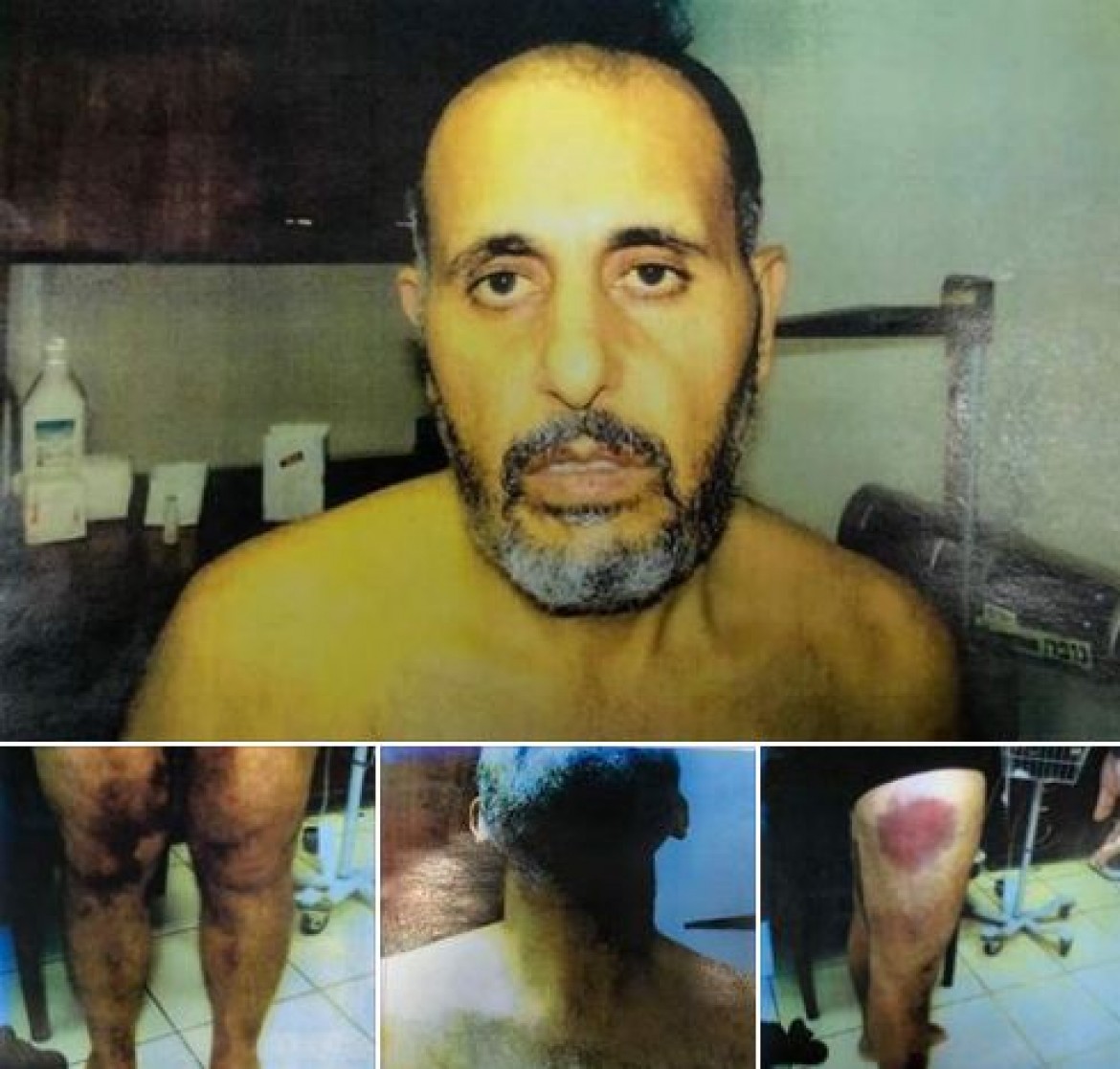 تعذيب حناتشة